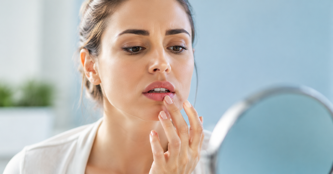 Why Cold Sores Keep Coming Back (And What You Can Do About It)