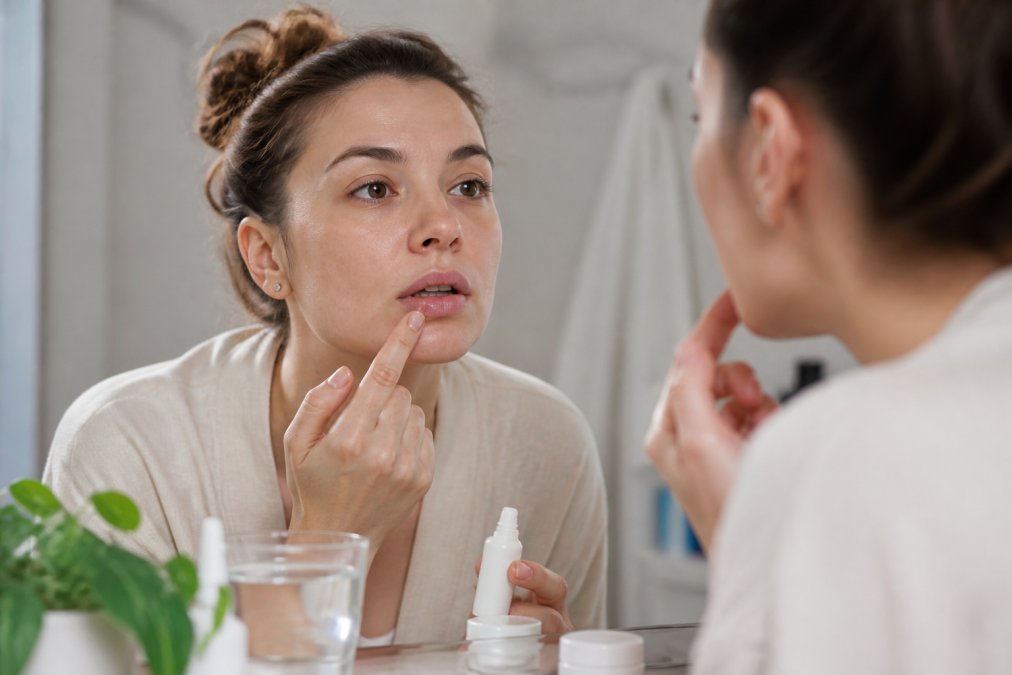 How to Treat Recurring Cold Sores: A Complete Guide