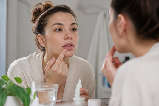 How to Treat Recurring Cold Sores: A Complete Guide